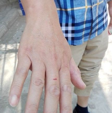 陈先生被同行殴打后,身上满是伤痕。